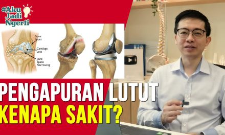 Kenali Gejala Pengapuran Lutut Yang Bisa Terjadi Pada Usia Muda
